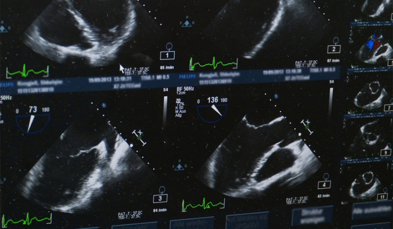 sonogram vs ultrasound