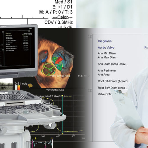 Echocardiogram (ECHO)