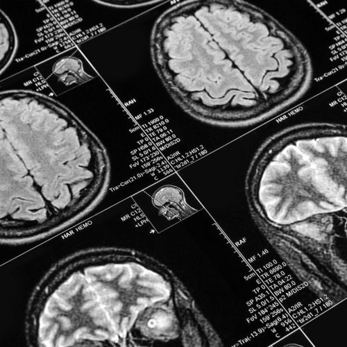 CT Scan / CTA