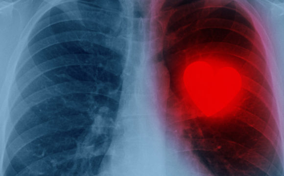 Radiology Subspecialties and the Professionals That Perform Them