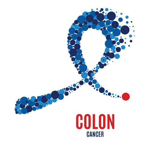 Can Colon Cancer Be Prevented?