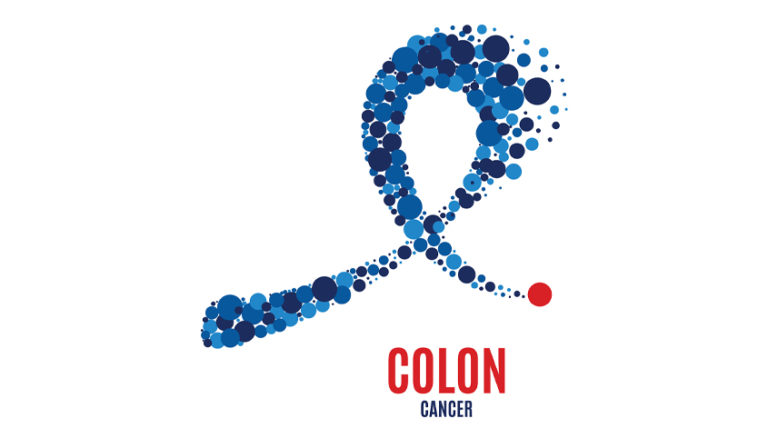 Can Colon Cancer Be Prevented Vital Imaging