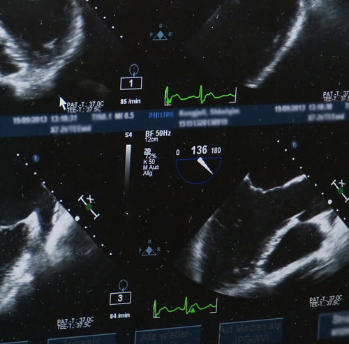 Ultrasound or Sonogram? What is the Difference?