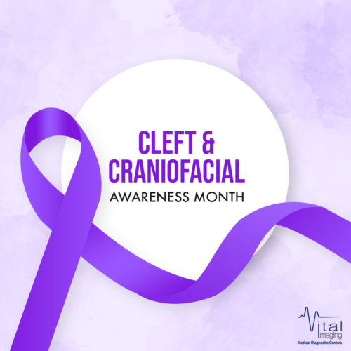 What You Need to Know About Cleft and Craniofacial Awareness and Prevention