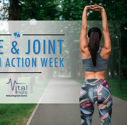 Understand the Importance of Bone and Joint Health Action Week