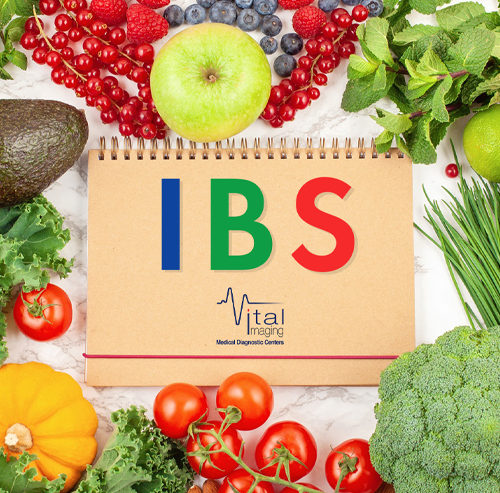 How Can I Know if I Am Suffering from Irritable Bowel Syndrome (IBS)?