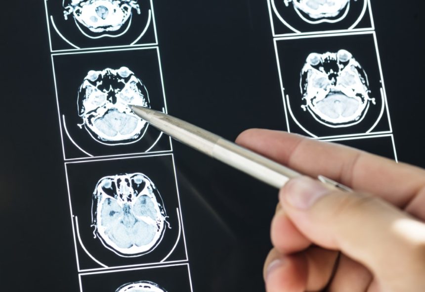 The Role of MRI’s and MRA’s in Diagnostic Imaging