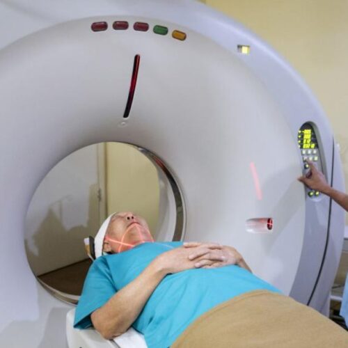 5 Benefits of MRI Over Other Imaging Techniques