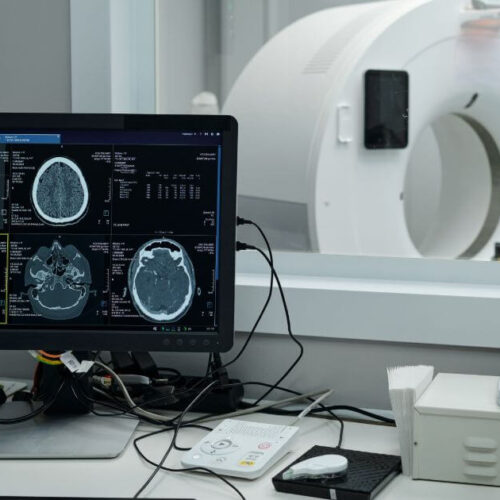 CT and CTA Scans Explained: A Simple Overview