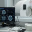 CT and CTA Scans Explained: A Simple Overview