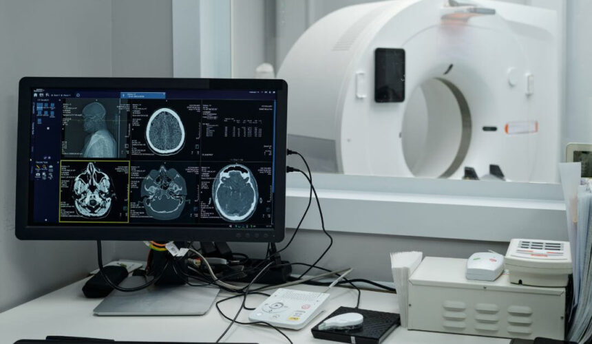CT and CTA Scans Explained CT and CTA Scans Explained: A Simple Overview