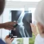 How Bone Density Scans Help Detect Osteoporosis Early
