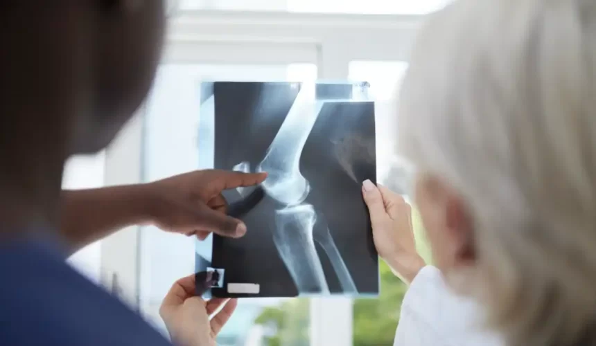 How Bone Density Scans Help Detect Osteoporosis Early