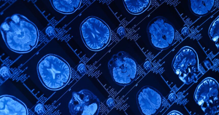 What Is Functional MRI What Is Functional MRI?