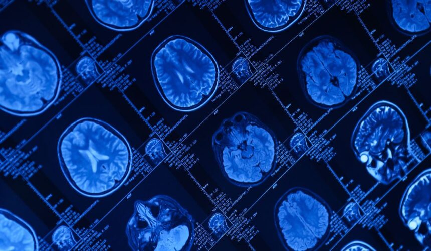 What Is Functional MRI?