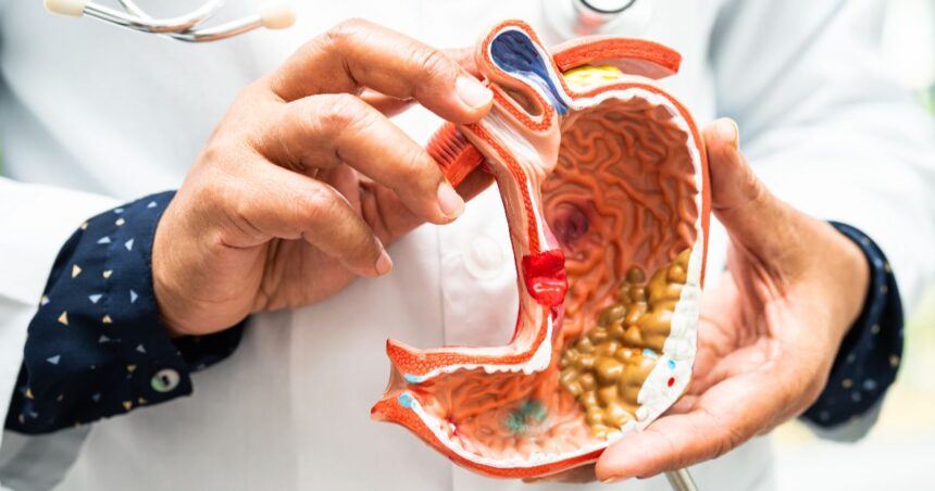 endoscopic retrograde cholangiopancreatography What Is an ERCP (Endoscopic Retrograde Cholangiopancreatography)?