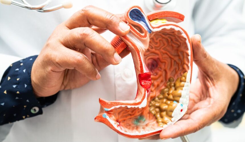 What Is an ERCP (Endoscopic Retrograde Cholangiopancreatography)?