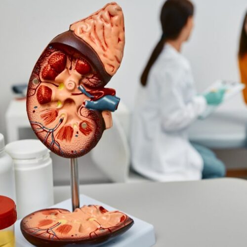 what is a blocked bile-duct What Is a Blocked Bile Duct?