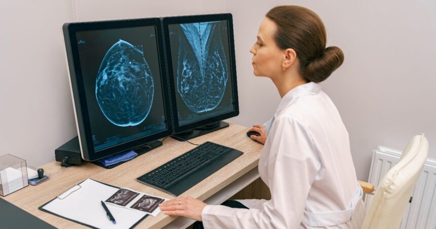 3D Tomosynthesis Mammogram: Complete Guide