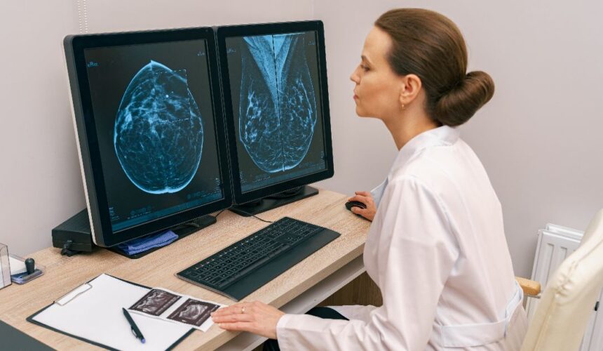 3d tomosynthesis mammogram complete guide 3D Tomosynthesis Mammogram: Complete Guide