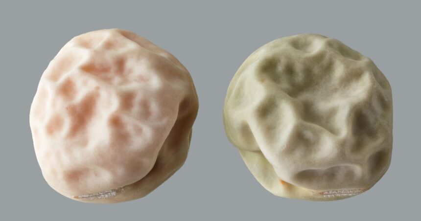 Cyst vs Tumor: Main Differences