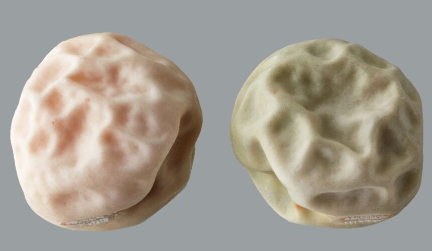 cyst vs tumor main differences Cyst vs Tumor: Main Differences