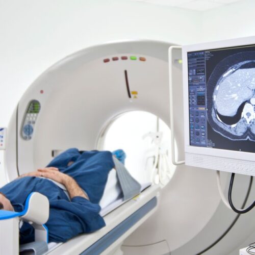 ct scan for kidney stones in miami what to expect CT Scan for Kidney Stones in Miami: What to Expect