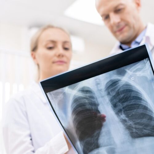 low-dose ct lung cancer screening in miami who qualifies Low-Dose CT Lung Cancer Screening in Miami: Who Qualifies