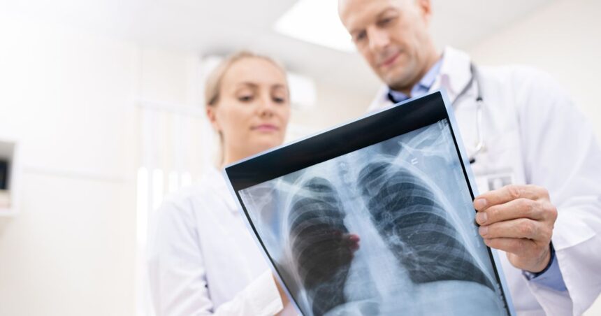 Low-Dose CT Lung Cancer Screening in Miami: Who Qualifies