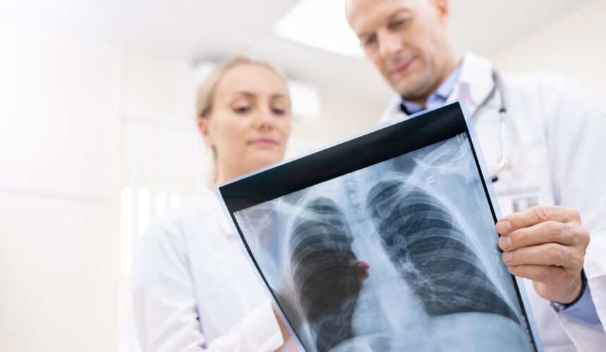 low-dose ct lung cancer screening in miami who qualifies Low-Dose CT Lung Cancer Screening in Miami: Who Qualifies