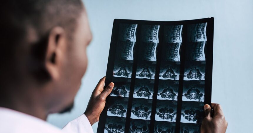 spine mri in miami cervical, thoracic, and lumbar explained Spine MRI in Miami: Cervical, Thoracic, and Lumbar Explained