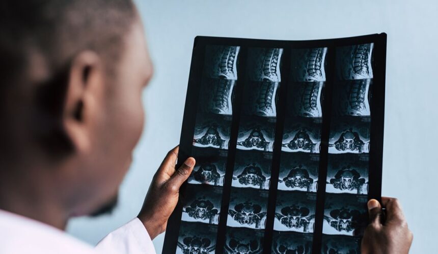 spine mri in miami cervical, thoracic, and lumbar explained Spine MRI in Miami: Cervical, Thoracic, and Lumbar Explained